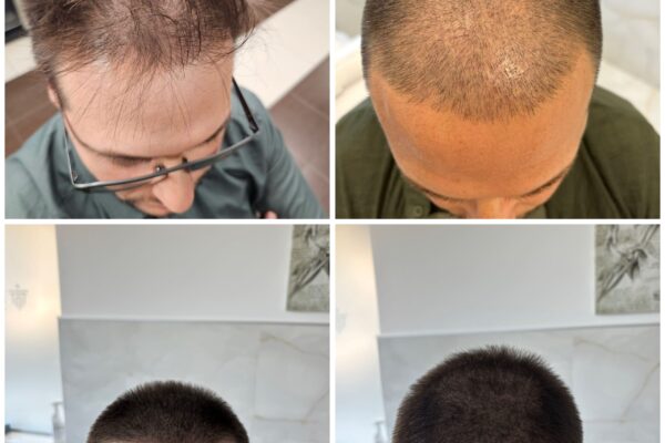 wellbe clinic results 1 wellbe clinic results 1