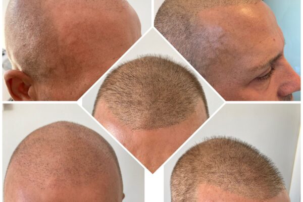 wellbe clinic results 2 wellbe clinic results 2