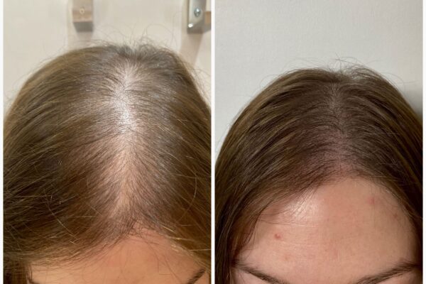 wellbe clinic results 3 wellbe clinic results 3