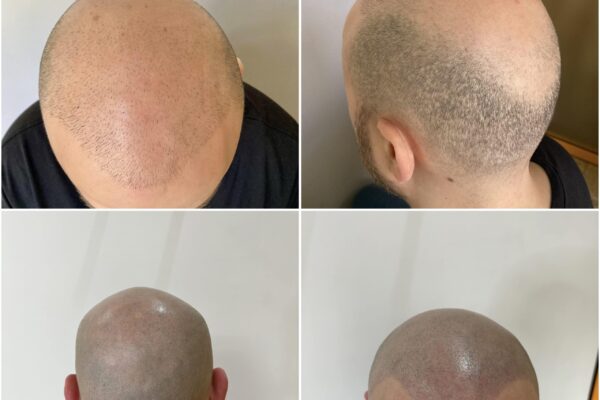 wellbe clinic results 4 wellbe clinic results 4