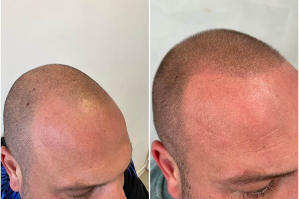 wellbe clinic results 5 wellbe clinic results 5